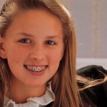 Braces for Kids When Should they get them?